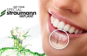 Navigációs fogbeültetés Móron a Regia Dental Fogászati Központban